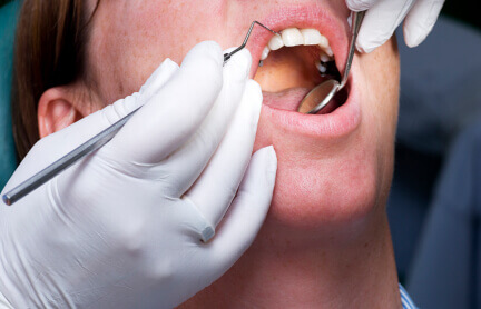 My Dentist at Morgan Creek - Man Dental Exam